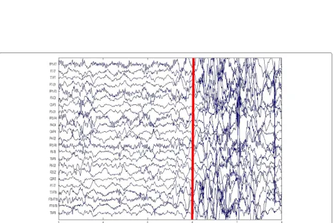 Fig. 2 The scalp EEG of patient A. The red bar marks the onset of a seizure. The EEG signals before this red bar are of non-seizure states and the EEGsignals after this red bar are of seizure states