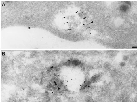 FIG. 6. Double labeling of MHV-infected cells with CT1a and LAMP-1 and with internalized 16-nm gold–BSA