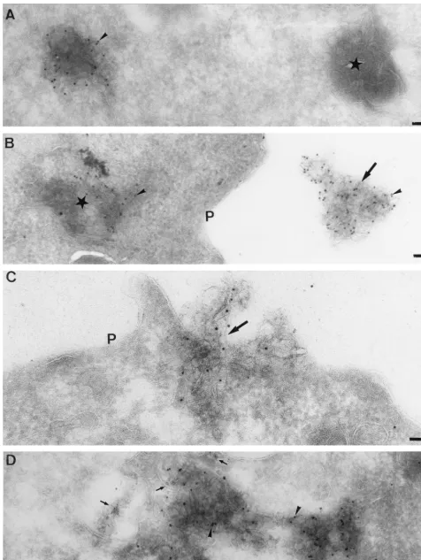 FIG. 7. Localization of the RNA-dependent RNA polymerase as seen by EM. Thawed cryosections of MHV-infected L cells were ﬁxed at 5 h p.i