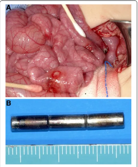 Fig. 7 Gastric perforation discovered on diagnostic gastroduodenoscopy