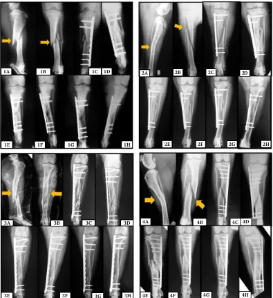 Figure 1. Photographic images of the radiographs of a patient group 1, 2, 3 and 4 in the experimental period