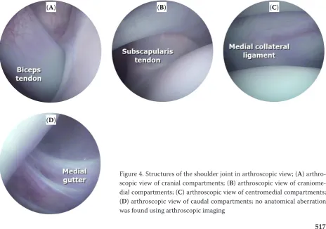 Figure 4. Structures of the shoulder joint in arthroscopic view; (A) arthro-scopic view of cranial compartments; (B) arthroscopic view of craniome-dial compartments; (C) arthroscopic view of centromedial compartments; (D) arthroscopic view of caudal compartments; no anatomical aberration was found using arthroscopic imaging