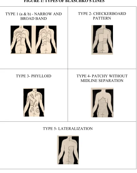 FIGGURE 1: TTYPES OF