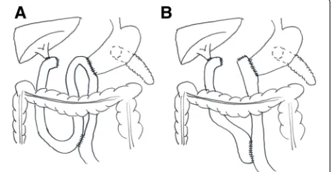 Fig. 2 Schematic drawing of pancreatoduodenectomy with Billroth-IIreconstruction (a) and Roux-en-Y reconstruction (b)