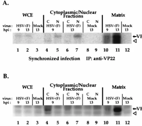 FIG. 8. Autoradiographic images (A) and immunoreactivities (B) of thophosphate was added, and after a 2-h incubation, radiolabel was removed