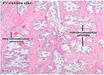 Figure 3: Normal histology of prostate 