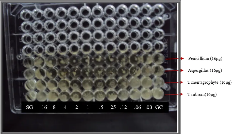 Figure28: Antifungal susceptibility testing- MIC90 of Griseofulvin 