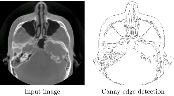 Figure 2.2: Canny Edge Detector