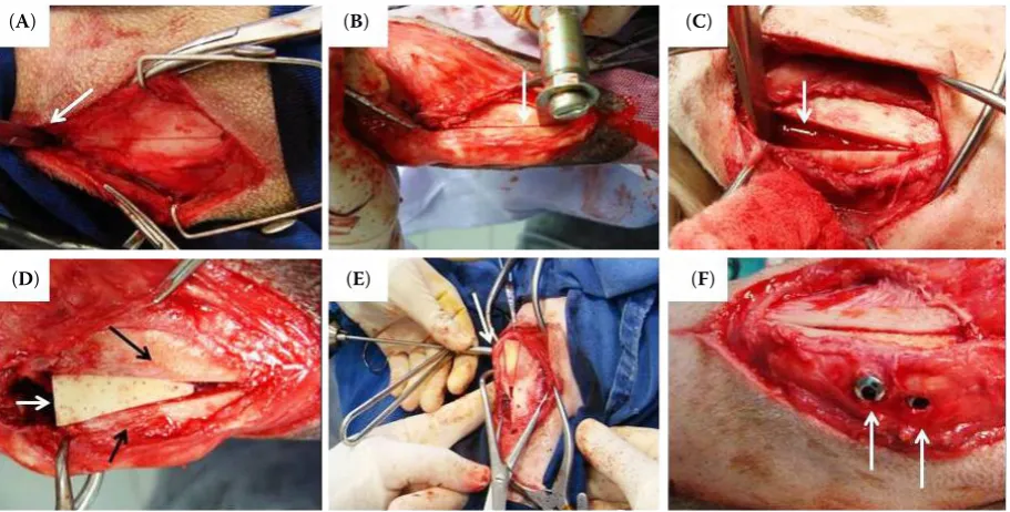Figure 3. Images of the medial aspect of the proximal tibia of dogs during TTAm: (Apositioned between the patellar ligament and joint capsule, delimiting the proximal limit of the tibial tuberosity (arrow head) in order to guide the osteotomy; (oscillating saw; () straight Kelly haemostat (arrow) B) longitudinal osteotomy of the tibial tuberosity (arrow) using an C) distraction of the tibial tuberosity away from the body of the tibia (arrow); (D) positioning of the polyurethane polymer implant (white arrow) between the tibial tuberosity (arrowhead) and the body of the tibia (black arrow); (E) craniocaudal perforation (arrow), with the aid of a driller for positioning the screws; (F) final aspect following setting the screws (arrows) craniocaudally through the tibial tuberosity, implant and tibia body