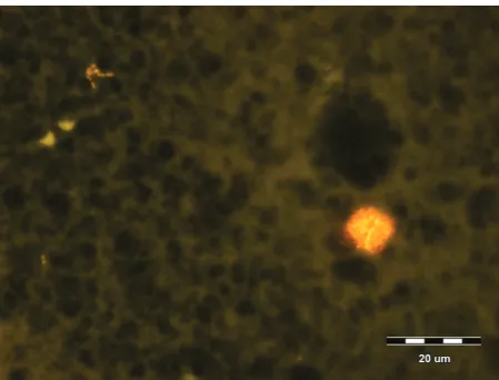 Figure 9. Method B, intensively red fluorescing nuclei of somatic cells, background is red, darkened particles are milk fat, a U-MNG2 lens unit with a filter generat-ing green light, was used, which caused EtBr to emit red light, magnification Í 600