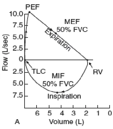 Fig 2: Normal flow-volume loop of spirometry 