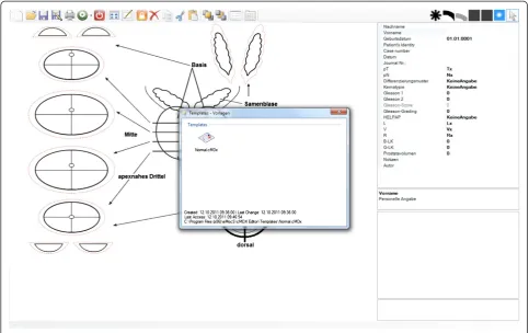 Figure 2 Graphical User Interface of the cMDX Editor. The main window of the “cMDX Editor” software.