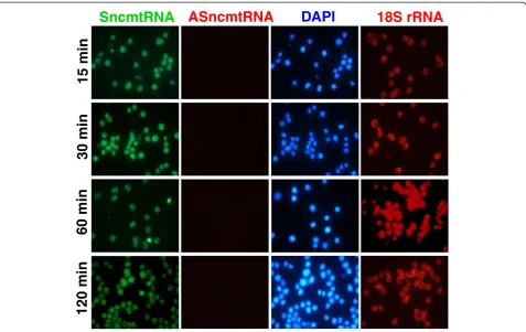 Figure 2 Hybridization kinetics on T-24 cells. After trypsinization, 105 cells were collected by centrifugation at 200 x g for 10 min and thepellet was subjected to S-FISH as indicated in Figure 1