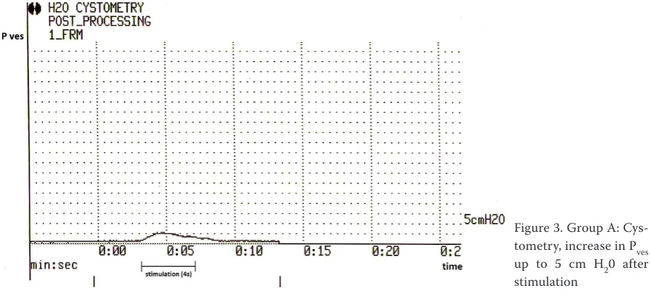 Figure 3. Group A: Cys-tometry, increase in P 