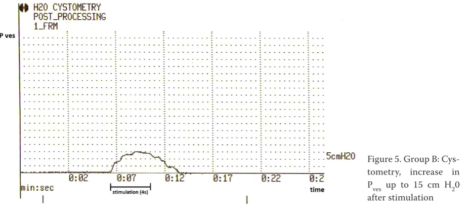Figure 5. Group B: Cys-tometry, increase in 