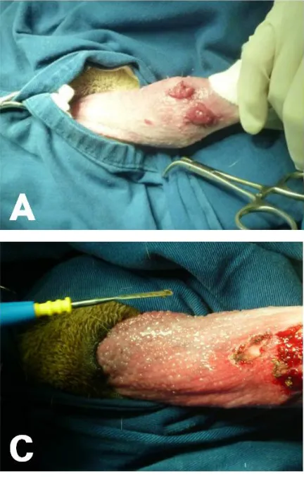 Figure 1. Large (A), fused (B), and scattered (C) nodules