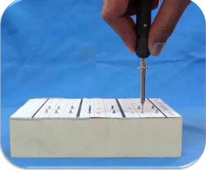 Figure 7: MSI Inserted With Free-Hand Method Without Guide 
