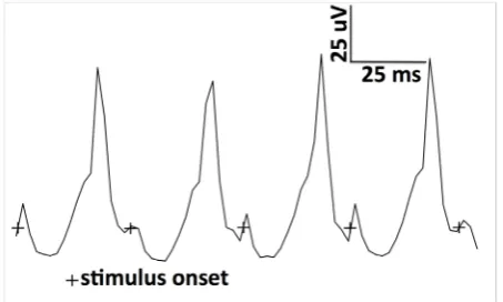 Figure 3. Electroretinogram from a normal five-year-old male dog demonstrates rod-driven response after 20 min of dark adaptation following low-intensity (0.03 cd·s/m2) flash stimulation
