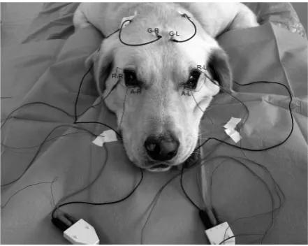 Figure 5. Electrode placement for simultaneous 2-chan-nel FERG recording, with the use of Kooijman-Damhof corneal electrodes with a built-in light source and a light diffusing contact lens (active electrodes: A-L and A-R for right and left side separately)