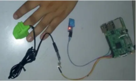 Fig. 7. heart rate sensor attached to the patient body 