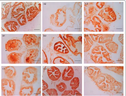 Figure 1 immunohistochemical expression of Bcl-xL (A), Caspase-3 (B) and Bax (C) in glands with tall epithelial lining in the controlgroup (1), OnaBotA group (2) and OnaBotA+PHE group (3)