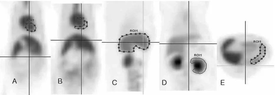 Figure 1. Depiction of representative regions of interest (ROI) manually drawn for image analysis and calculation of standardised uptake values over a 90 min time period for the thoracic and abdominal organs of five normal cats (A) blood pool ROI in the frontal plane, (B) myocardial ROI, (C) hepatic ROI in the sagittal plane, (D) renal cortical ROI in the frontal plane, (E) splenic ROI in the transverse plane