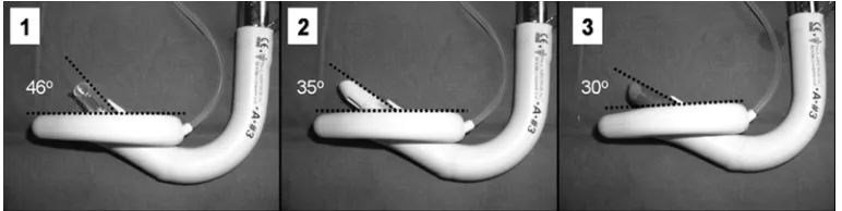 Figure 8: Comparison of emerging angle of FTST, PVC and LAT tubes 