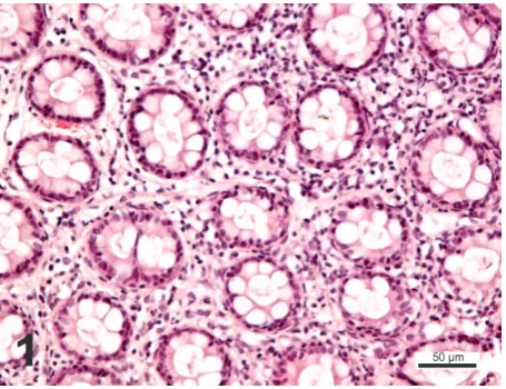 Figure 2. Hyperaemia of the colonic mucosa with focal extravasation in a dog administered robenacoxib for 21 days; HE staining