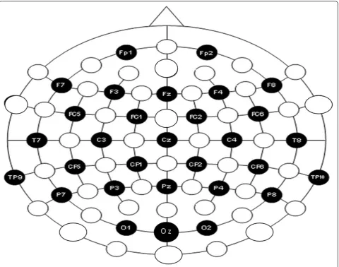 Fig. 1 Electrode positions