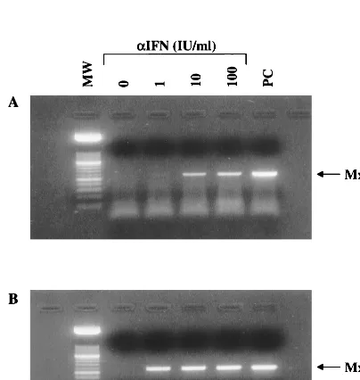 FIG. 2. Induction of MxA gene expression by IFN-�RT-PCR of total RNA from BCBL-1 cells not induced (A) or induced (B) withTPA and cultured for 24 h in the absence or presence of the indicated amountsof IFN-RNA from K562 cells induced with 100 IU of IFN-was