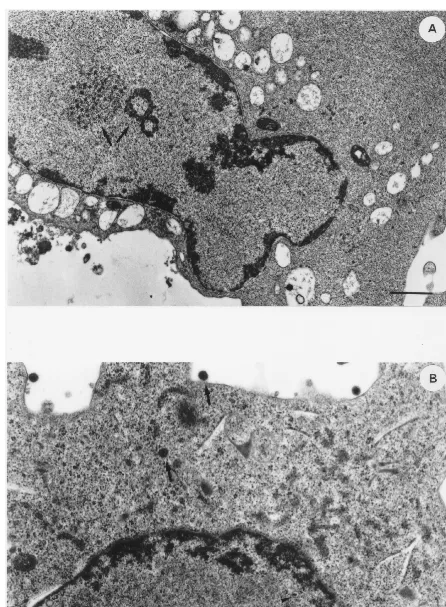 FIG. 4. Thin-section electron micrographs of BCBL-1 cells induced with TPA (20 ng/ml) for 48 h in the absence (A and B) or presence (C and D) of anti-IFN-�Ab (100 IU/ml)