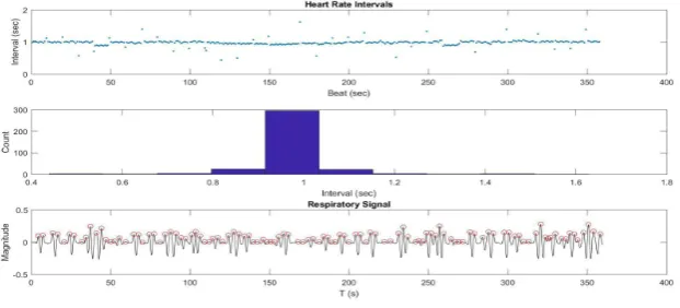 Fig. 2. Parameters extracted from ECG signals 