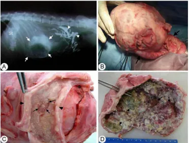 Figure 1. (A) The contrast radiogram. The tumour mass had well defined borders (arrows) adjacent to the intestines (arrowheads, St = stomach)
