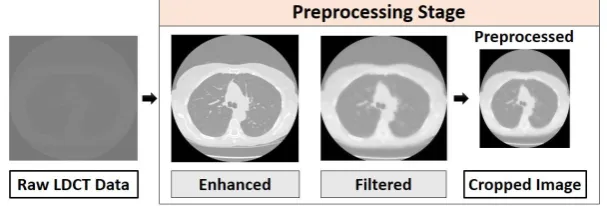 Fig. 3. Preprocessing raw LDCT data in three steps: histogram stretching to improve image contrast, image smoothing using Wiener filer, and cropping to the standard input size of the CNN model used for feature extraction 