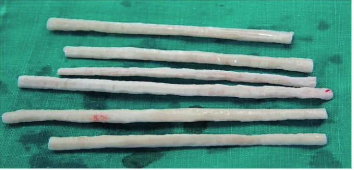 Figure 1. The antigen-free freeze-dried cortical bones were defatted with chloroform and methanol and were freeze-dried at –80 °C before sterilization with EO gas and storage at room temperature