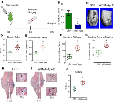 Figure 6. Decreasing circulating ApoE levels improves bone regeneration in aged mouse models