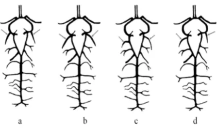 Figure 2. Different variants of the departure of the caudal cerebral artery