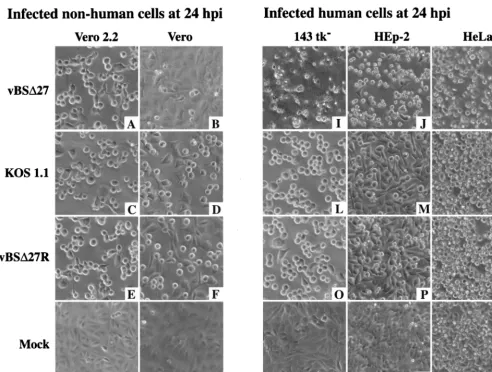 FIG. 1. Morphologies of infected nonhuman (A to H) Vero 2.2 and Vero cells and human (I to T) 143tk�(A, B, and I to K), KOS1.1 (C, D, and L to N), or vBSlight microscopy (magniﬁcation,, HEp-2, and HeLa cell lines