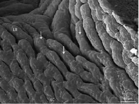 Figure 5. Dorsal lingual surface in the area of the lingual body (LC) and the lingual radix (LR)