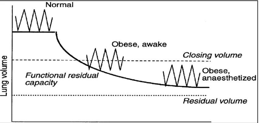 FIG. 3: CHANGE IN LUNG VOLUMES WITH OBESITY(52) 