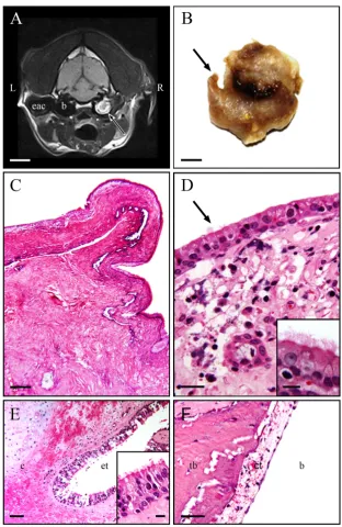 Figure 1.  = magnetic resonance image showing a transversal scan section of the skull (fluid attenuated inversion (arrow) connecting the polyp to its origin in the Eustachian tube