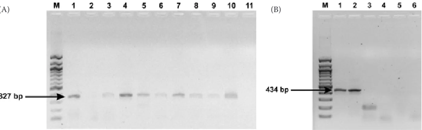 Figure 1. (A) Results of Group C rotavirus detection by semi-nested PCR: M = size marker; 1 to 9 = corresponds  to the samples P669/2, P724, P902/2, P902/3, P905/2, P915/1, P919/3, P924/3 and P996/2; 10 = positive control;  11 = negative control