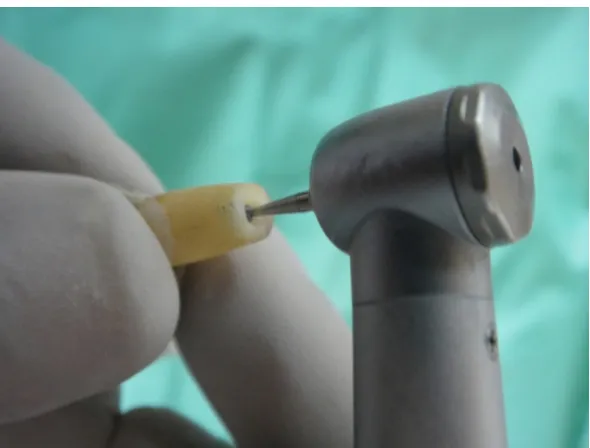 Fig.3: Horizontally cut 7 mm from apex                                                                     