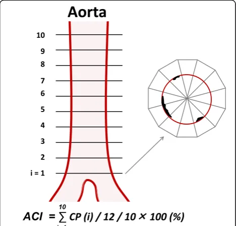 Fig. 1 Patient selection and measurement of aortic calcification index(ACI). Aortic calcification was quantitatively measured using preoperativeabdominal computed tomography images, evaluating 10 slices scannedat 5-mm intervals above the abdominal aortic b