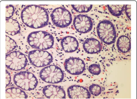 Figure 3 IBS-D patient with normal histology.
