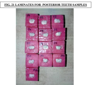 FIG. 21 LAMINATES FOR  POSTERIOR TEETH SAMPLES 