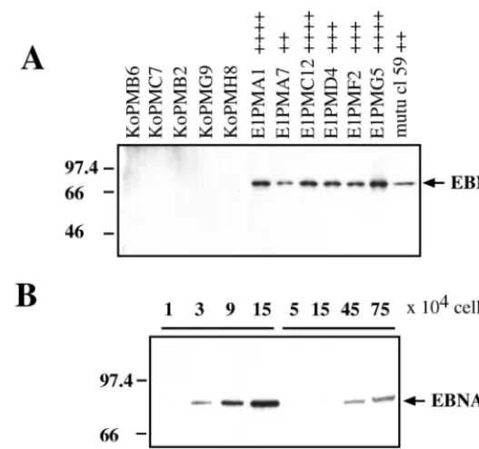 FIG. 1. Immunoblot of EBNA-1 expression in L428 cells (A) and LCL 304 (B). The immunoblots were probed with rat anti-EBNA-1 (1H4) monoclonal antibody.(A) Representative vector control (pSG5–pSV-PAC) L428 clones and pSG5-EBNA-1–pSV-PAC-expressing L428 clone