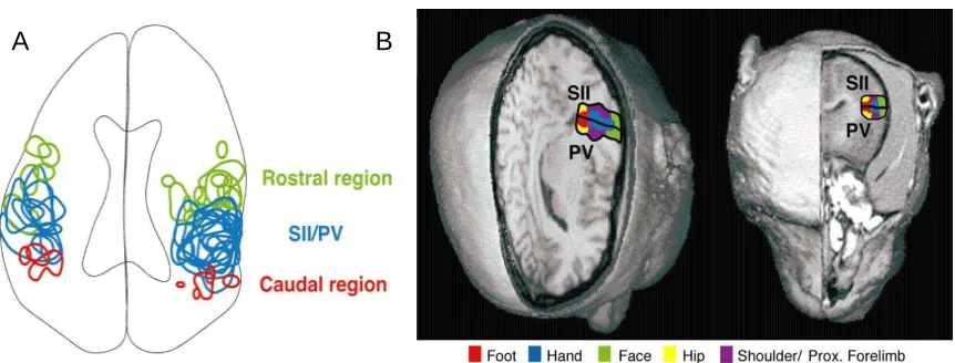 Figure 8. A: Reconstruction of an axial slice through the lateral sulcus with the activity patterns from all 16 cases collapsed onto a single drawing