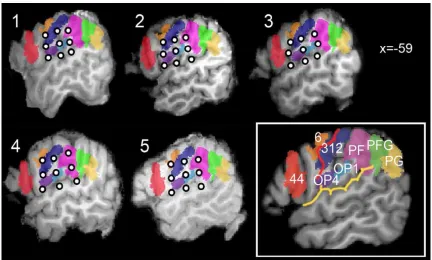 Figure 11. Individual MRI scans of the 5 participants to experiment I at the sagittal section corresponding to x=-59