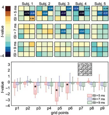 Figure 12. Upper panel: individual statistical maps of the t-values obtained contrasting the distribution of log(condMEP+testMEP / testMEP) against the null hypothesis of the mean value = 0